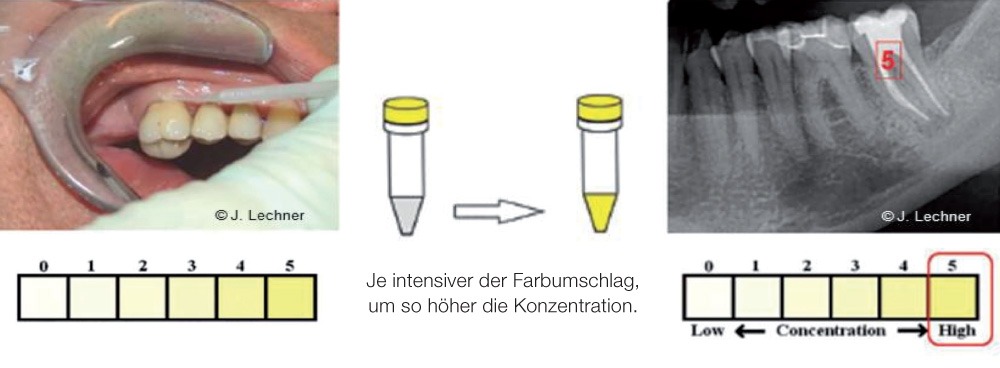 OroTox®-Test